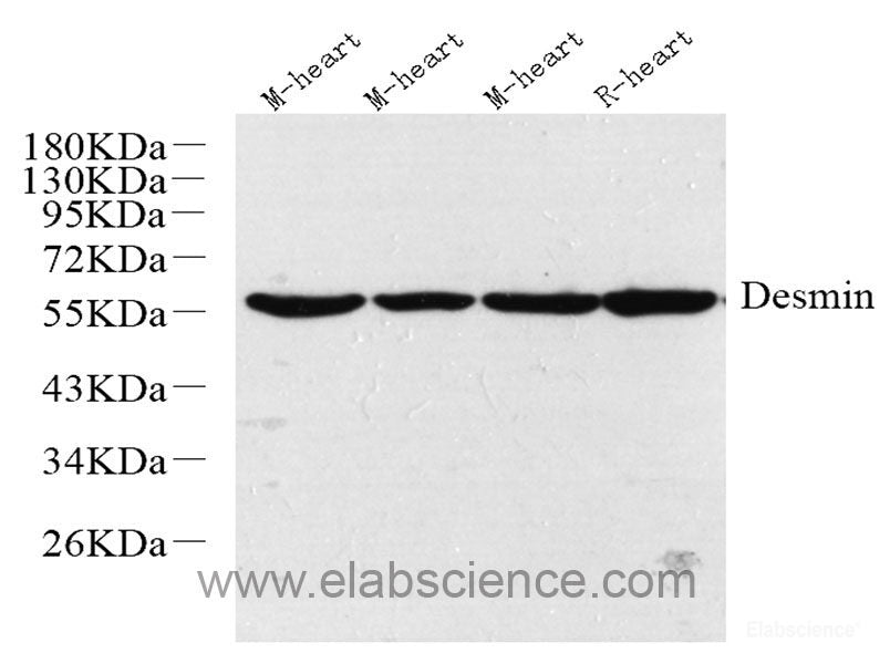 Immunohistochemistry analysis of paraffin-embedded mouse liver using E-Cadherin Monoclonal Antibody at dilution of 1:300.