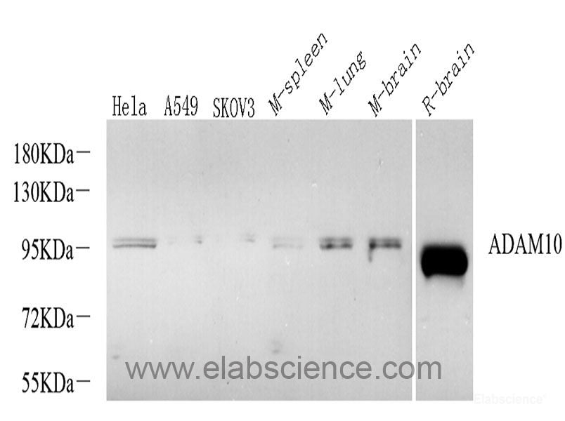 Immunohistochemistry analysis of paraffin-embedded mouse brain using AIF1 Polyclonal Antibody at dilution of 1:300.