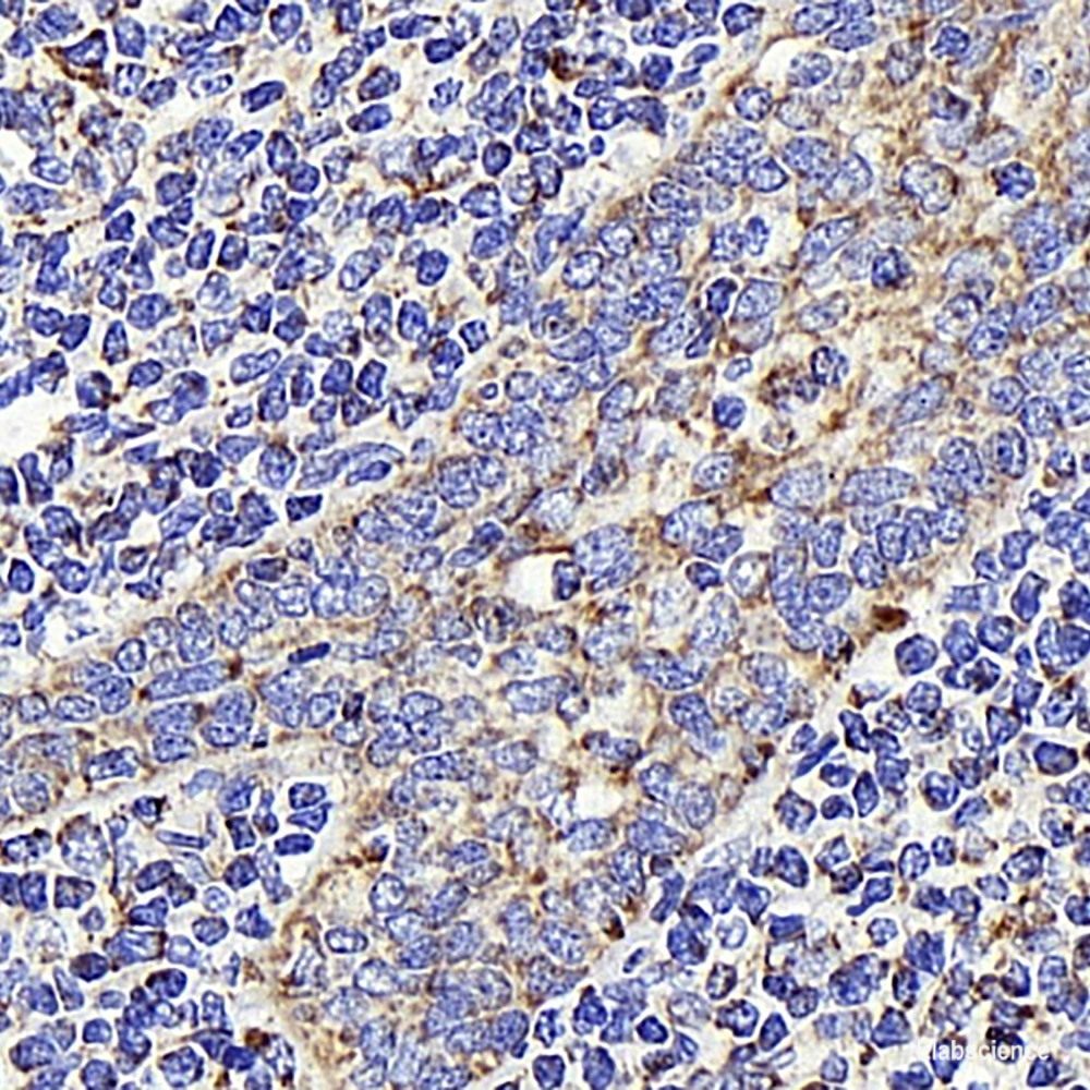 Immunohistochemistry analysis of paraffin-embedded human liver using Connexin-40 Polyclonal Antibody at dilution of 1:400.