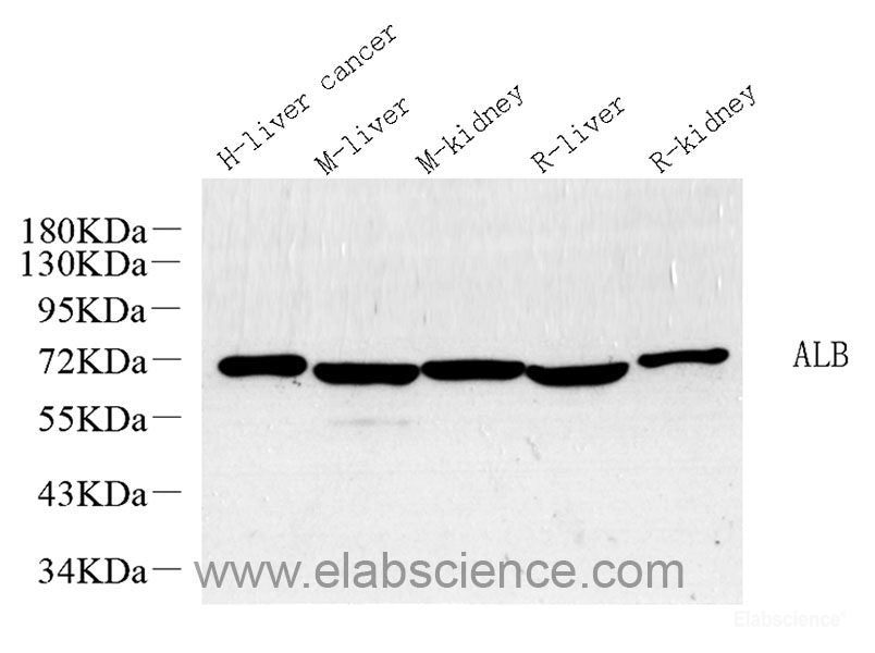 Western Blot analysis of various samples using PI 3 kinase p85 alpha Polyclonal Antibody at dilution of 1:1000.