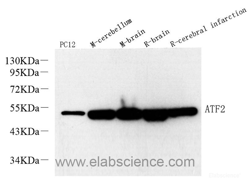 Western Blot analysis of various samples using CYCS Polyclonal Antibody at dilution of 1:1000.