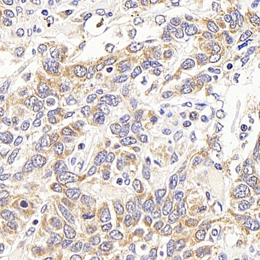 Immunohistochemistry analysis of paraffin-embedded human tonsil using TLR9 Polyclonal Antibody at dilution of 1:200.