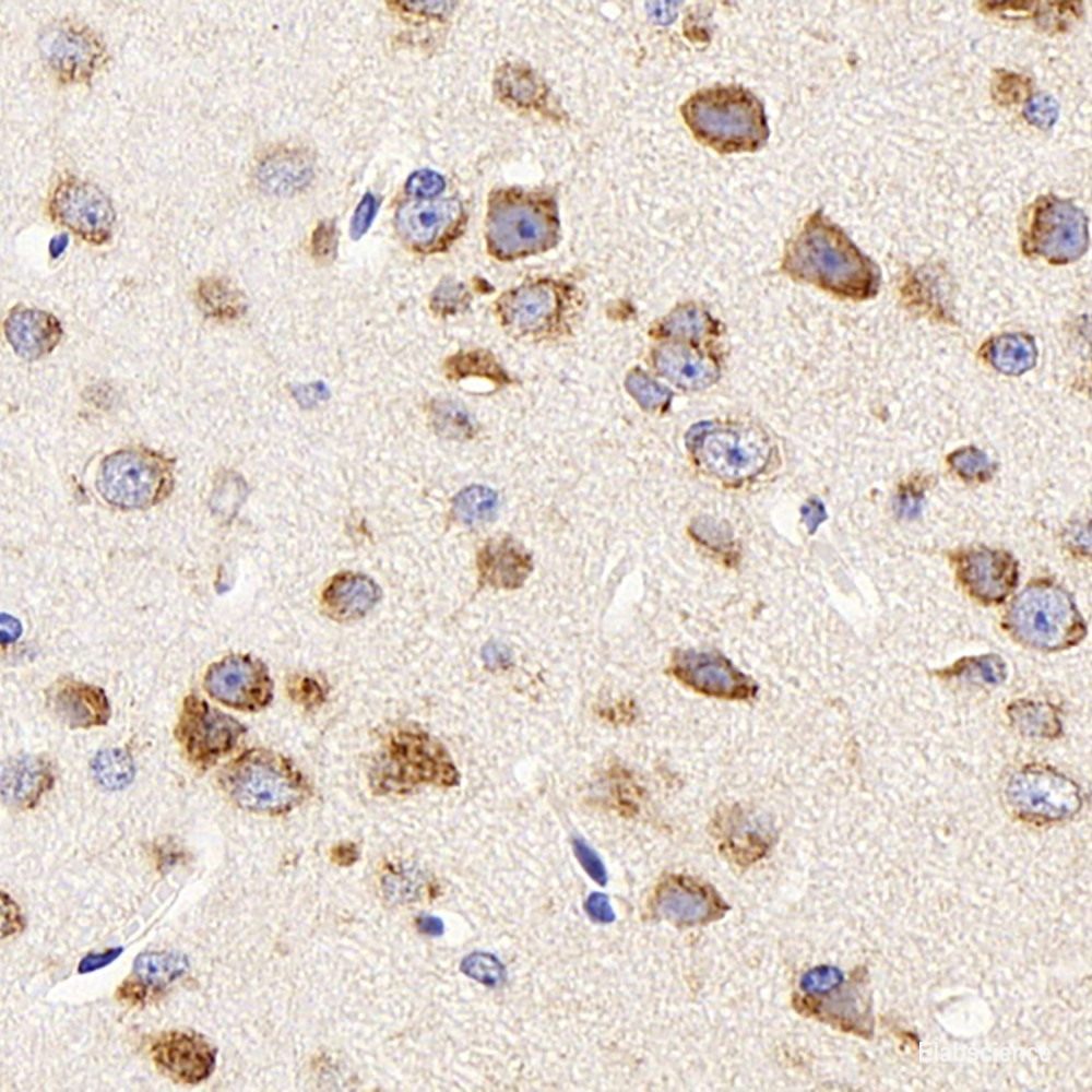 Immunohistochemistry analysis of paraffin-embedded rat brain using AQP4 Polyclonal Antibody at dilution of 1:400.