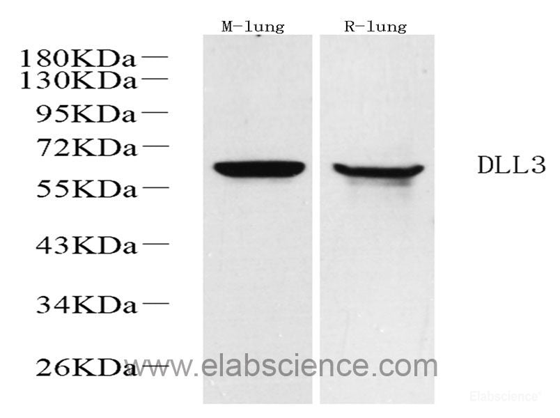 Immunohistochemistry analysis of paraffin-embedded human kidney using NES Monoclonal Antibody at dilution of 1:400.
