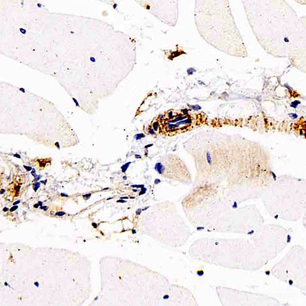 Immunohistochemistry analysis of paraffin-embedded mouse liver using CD45 Polyclonal Antibody at dilution of 1:500.