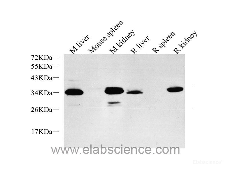 Immunohistochemistry analysis of paraffin-embedded mouse skeletal muscle using GLUT-4 Polyclonal Antibody at dilution of 1:500.