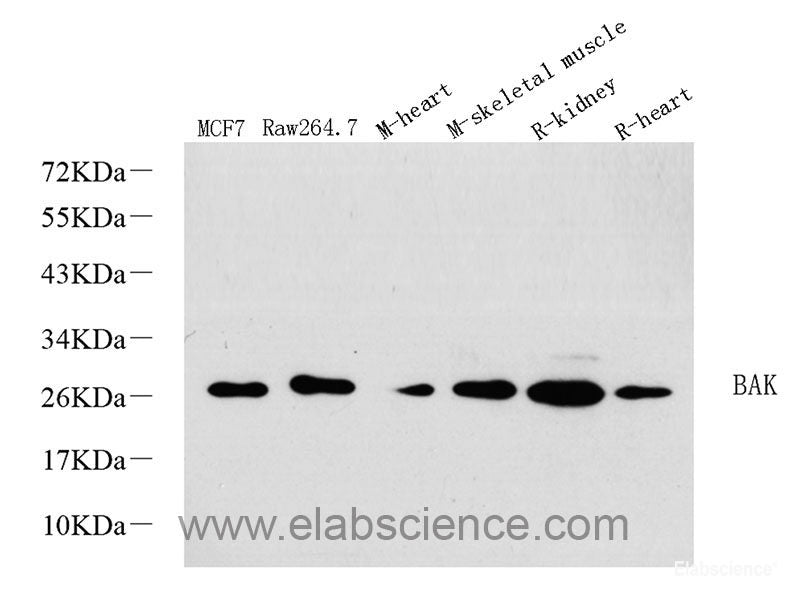 Immunohistochemistry analysis of paraffin-embedded human tonsil using CD169 Polyclonal Antibody at dilution of 1:300.