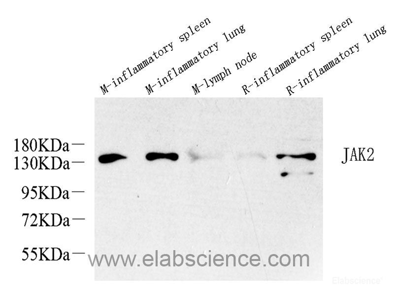Immunohistochemistry analysis of paraffin-embedded mouse striatum using TH Monoclonal Antibody at dilution of 1:1000.