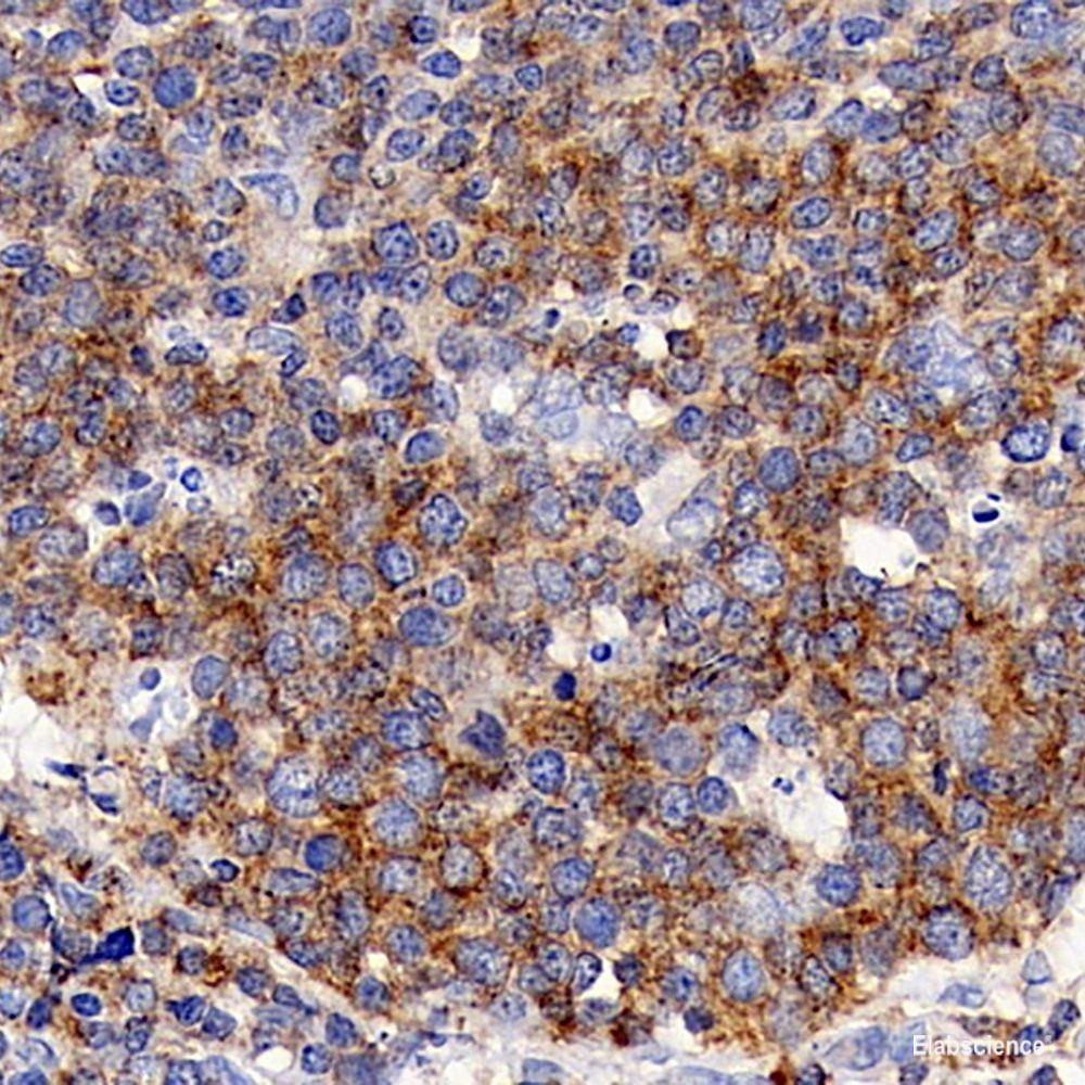 Immunohistochemistry analysis of paraffin-embedded mouse brain using AIF1 Monoclonal Antibody at dilution of 1:400.