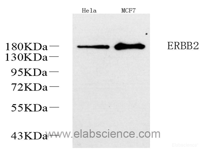 Immunohistochemistry analysis of paraffin-embedded human tonsil using PERK Polyclonal Antibody at dilution of 1:400.