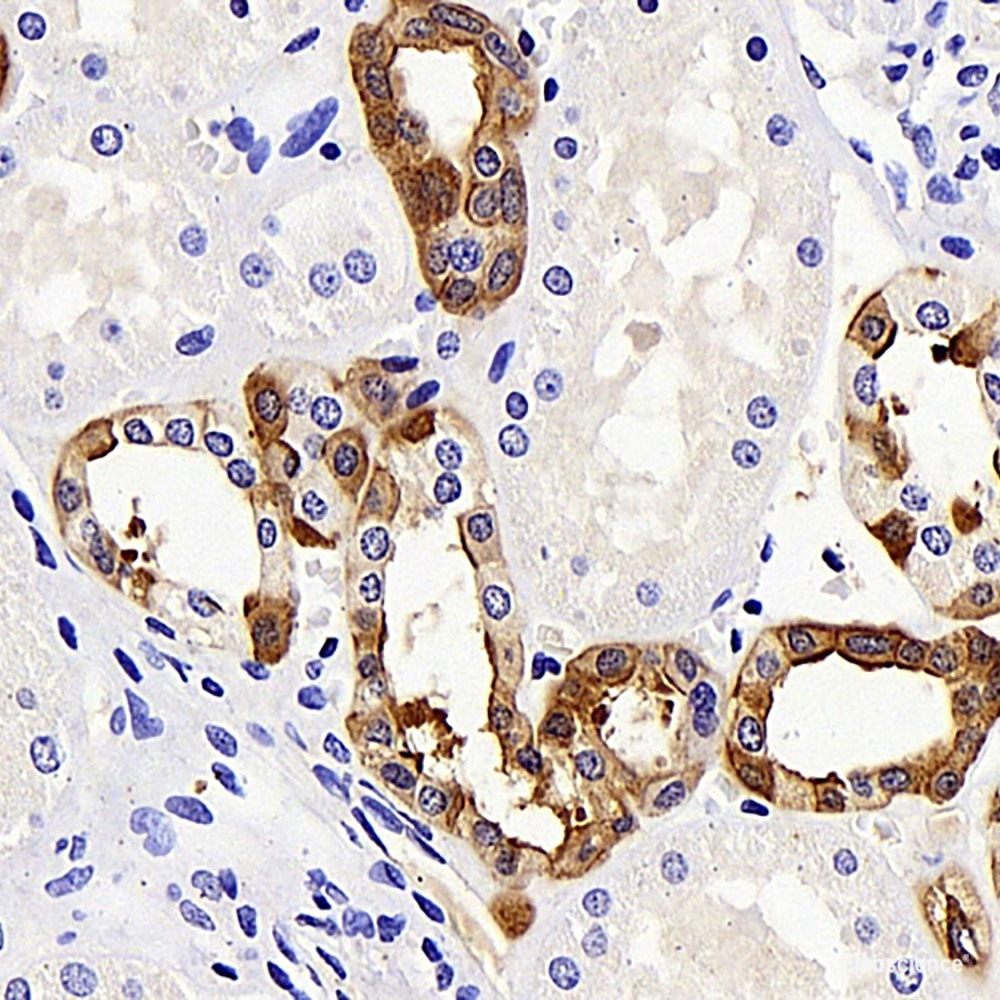 Immunohistochemistry analysis of paraffin-embedded human tonsil using CD192 Polyclonal Antibody at dilution of 1:300.