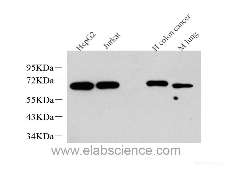 Immunohistochemistry analysis of paraffin-embedded mouse kidney using NPHS1 Polyclonal Antibody at dilution of 1:1000.