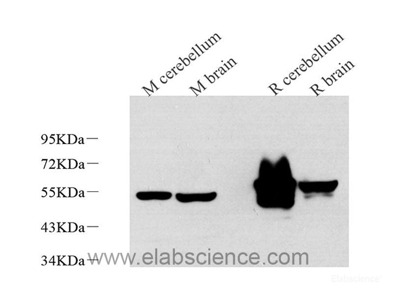 Western Blot analysis of various samples using Mineralocorticoid receptor Polyclonal Antibody at dilution of 1:600.