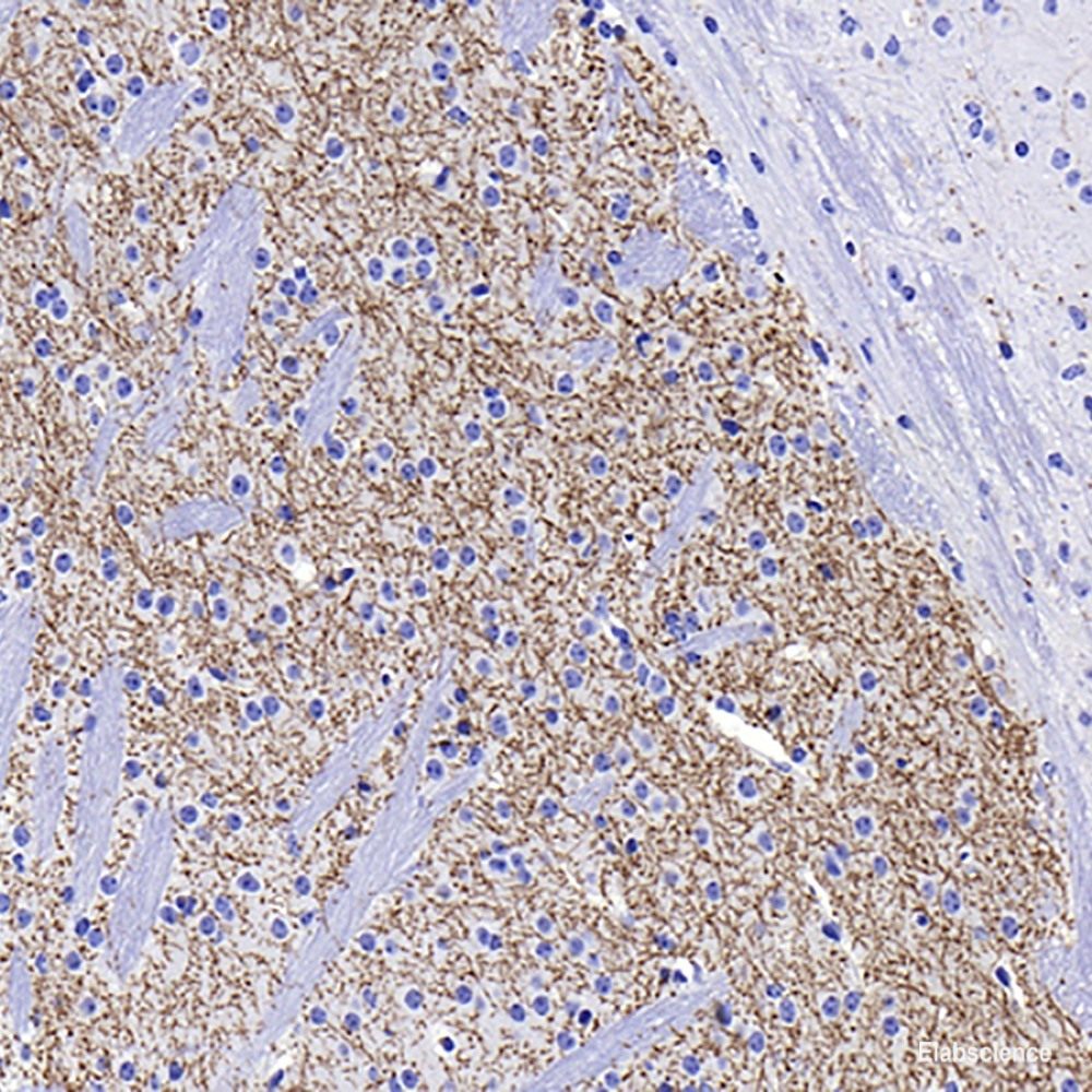 Immunohistochemistry analysis of paraffin-embedded human stomach using Mineralocorticoid receptor Polyclonal Antibody at dilution of 1:300.