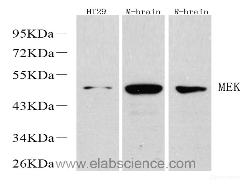 Western Blot analysis of various samples using EGFR Polyclonal Antibody at dilution of 1:1000.