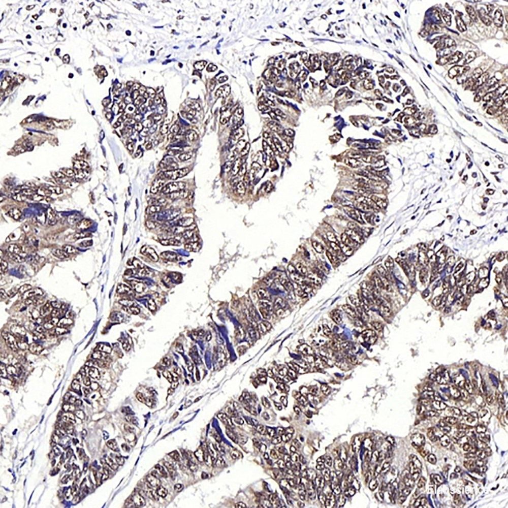 Immunohistochemistry analysis of paraffin-embedded Mouse muscle using MYL2 Polyclonal Antibody at dilution of 1:300.