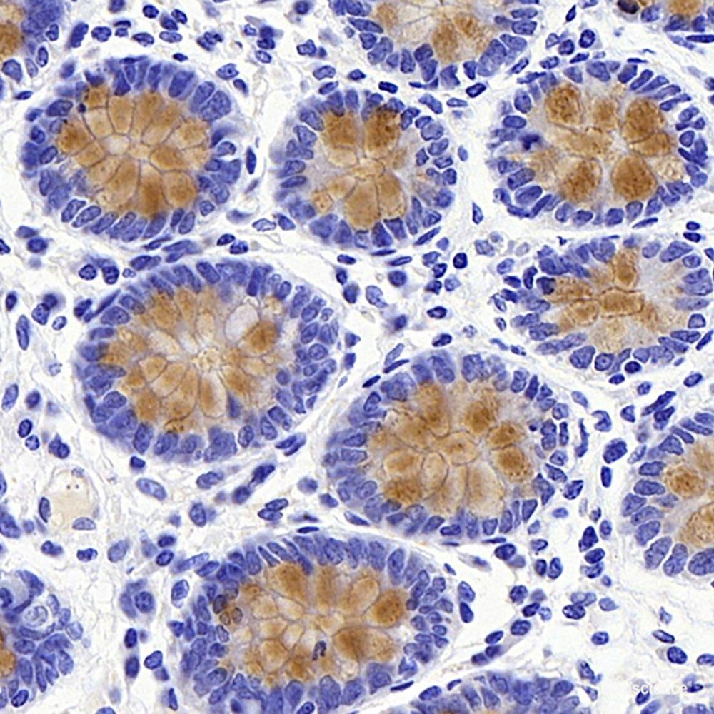 Immunohistochemistry analysis of paraffin-embedded mice tumor with hela using SOX-2 Polyclonal Antibody at dilution of 1:300.