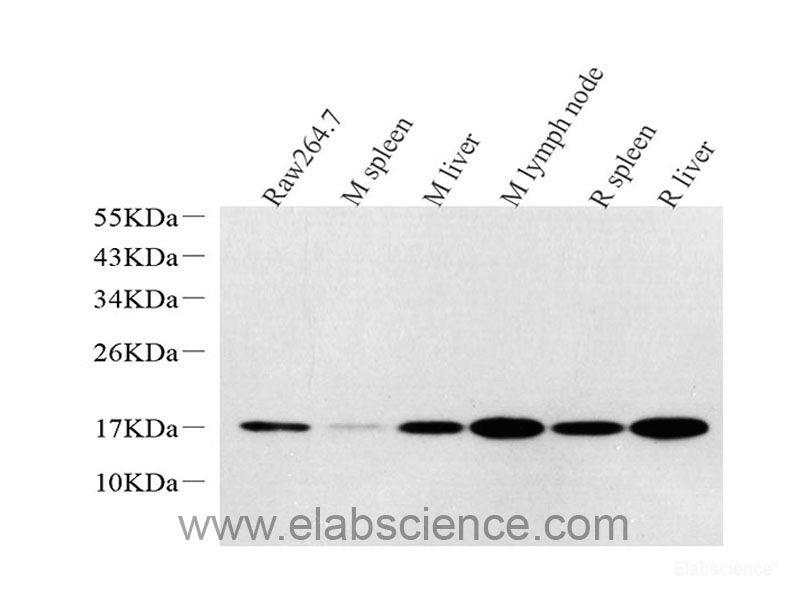 Western Blot analysis of various samples using AQP1 Polyclonal Antibody at dilution of 1:2000.