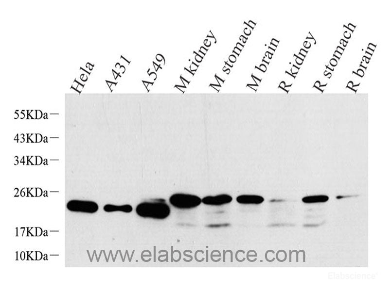Immunohistochemistry analysis of paraffin-embedded human kidney using AQP3 Polyclonal Antibody at dilution of 1:300.