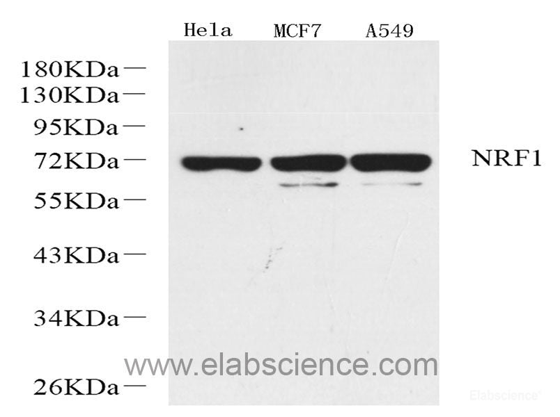 Immunohistochemistry analysis of paraffin-embedded human lung cancer using JUN Polyclonal Antibody at dilution of 1:500.
