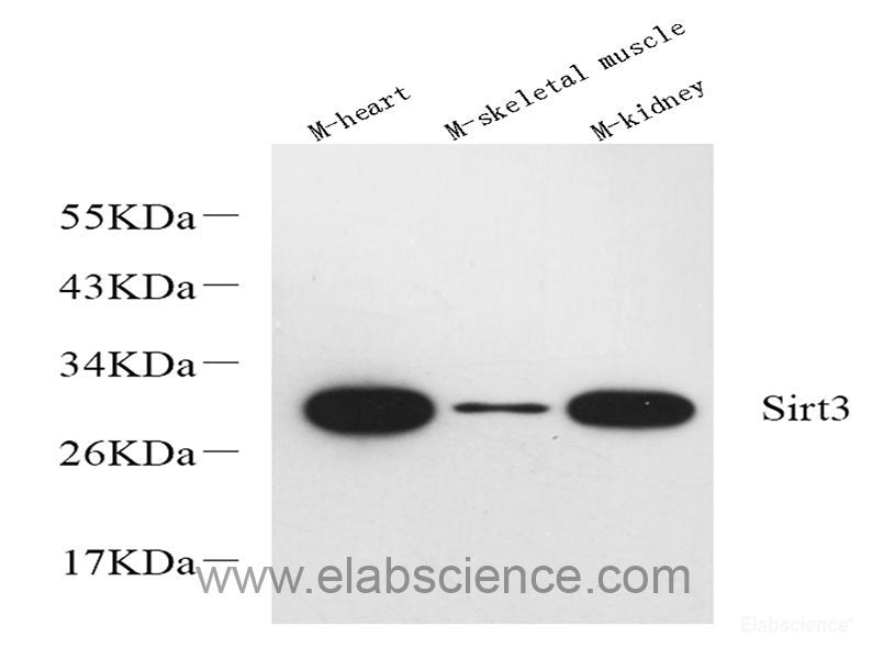 Western Blot analysis of various kidney using LC3A/B Polyclonal Antibody at dilution of 1:1000.