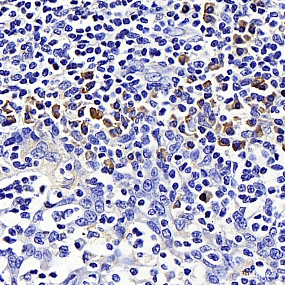 Immunohistochemistry analysis of paraffin-embedded human tonsil using CD284 Polyclonal Antibody at dilution of 1:500.