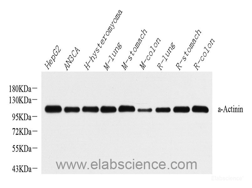 Western Blot analysis of various samples using Vimentin Polyclonal Antibody at dilution of 1:1000.