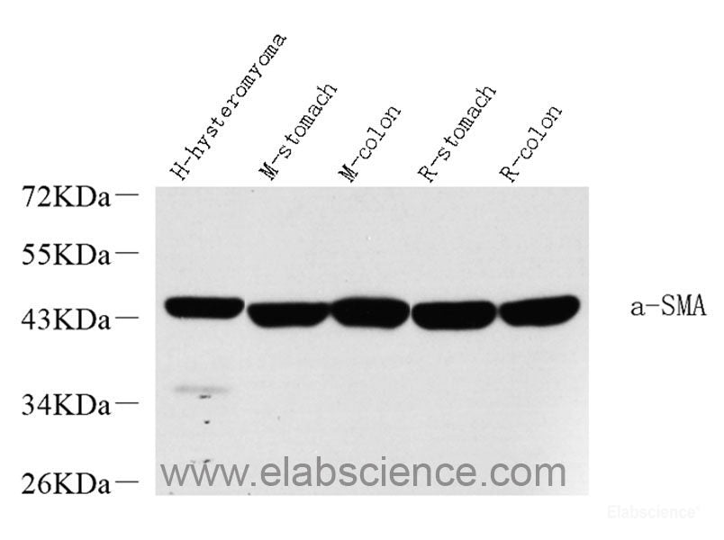 Immunohistochemistry analysis of paraffin-embedded human kidney using COL18A1 Polyclonal Antibody at dilution of 1:400.