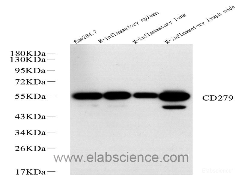 Immunohistochemistry analysis of paraffin-embedded human kidney using PMVK Polyclonal Antibody at dilution of 1:1000.