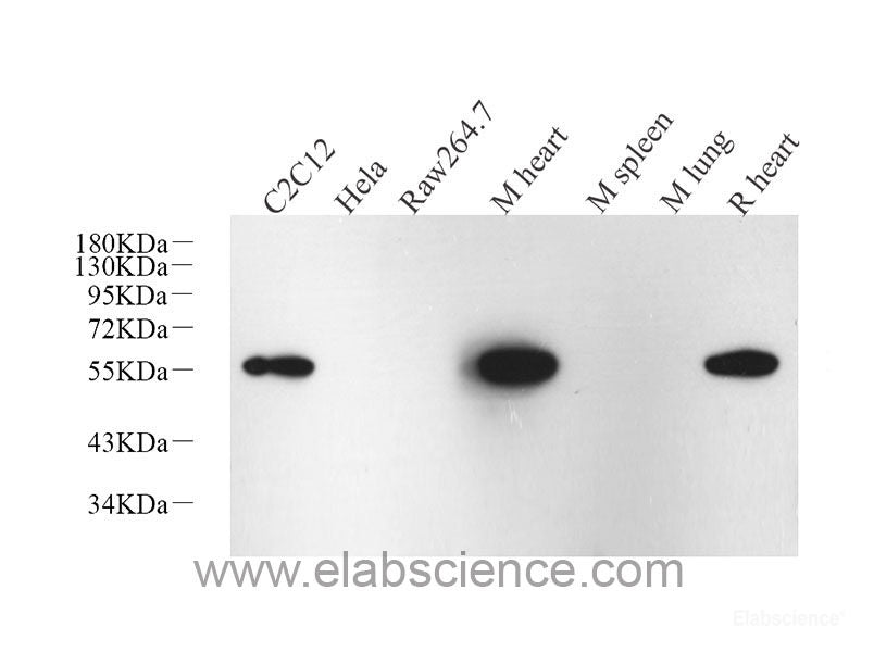 Immunohistochemistry analysis of paraffin-embedded mouse stomach using CK-19 Monoclonal Antibody at dilution of 1:1000.