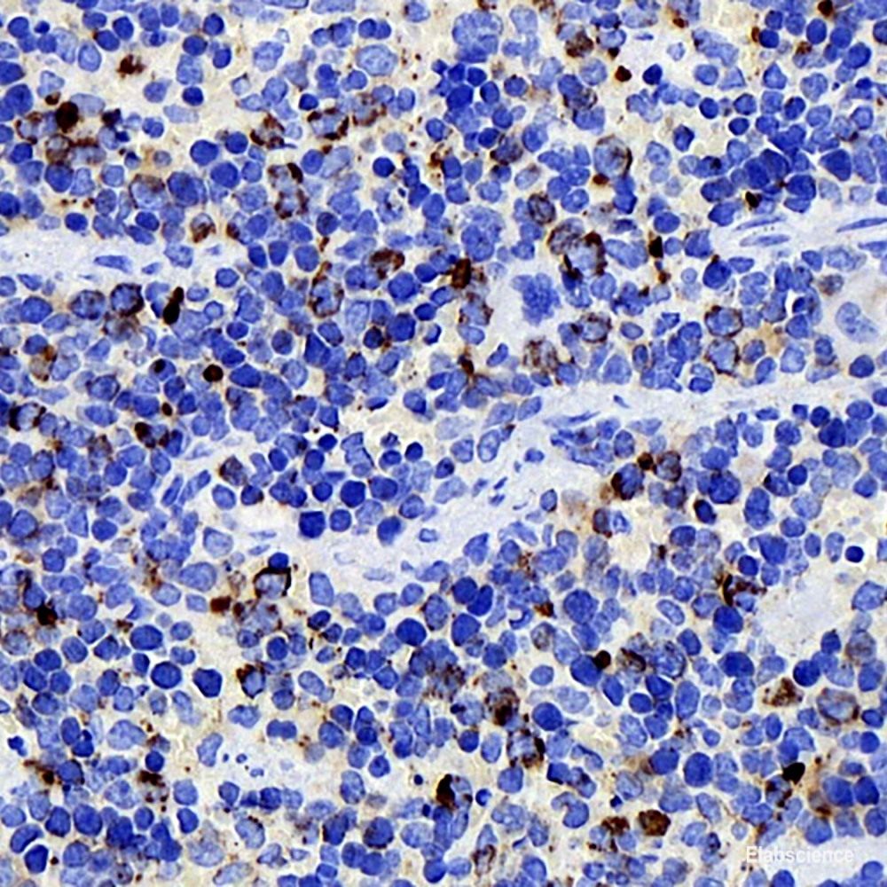 Western Blot analysis of various samples using Phospho-ERK 1/2 (Thr202/Tyr204) Polyclonal Antibody at dilution of 1:800.