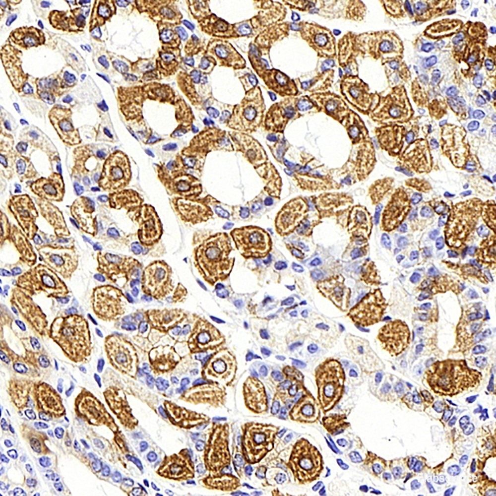 Immunohistochemistry analysis of paraffin-embedded mouse adipose tissue using PPARG Monoclonal Antibody at dilution of 1:1000.
