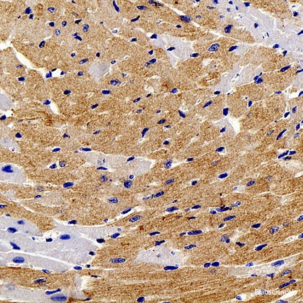 Immunohistochemistry analysis of paraffin-embedded human kidney using JUN Polyclonal Antibody at dilution of 1:1000.