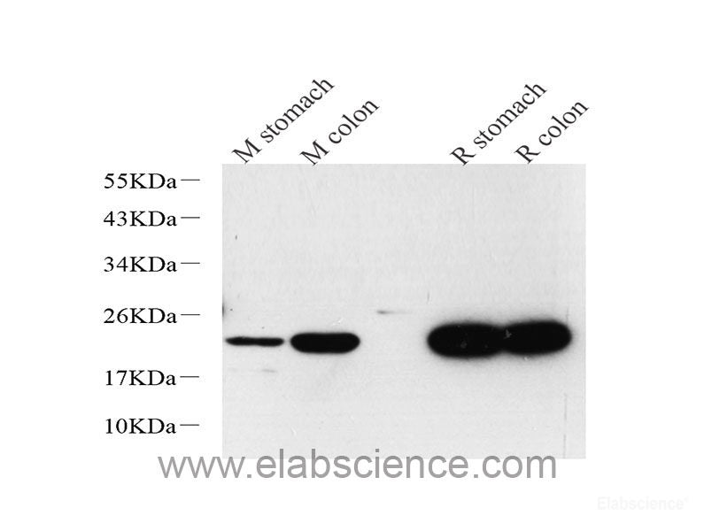 TAGLN Polyclonal Antibody