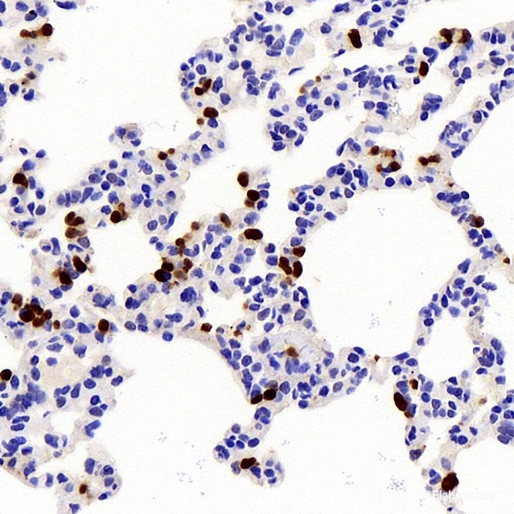 IL10 Polyclonal Antibody