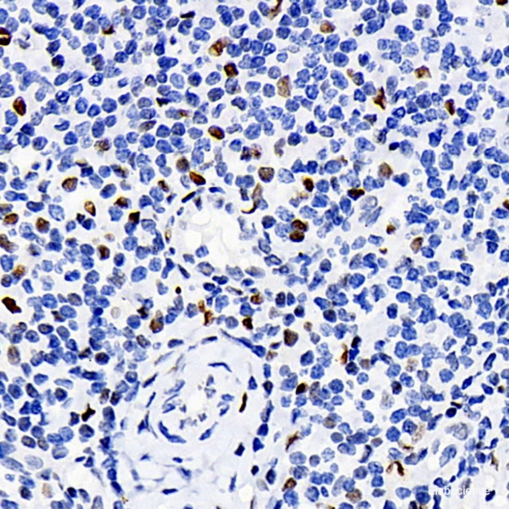Immunohistochemistry analysis of paraffin-embedded human colon using CHOP Polyclonal Antibody at dilution of 1:300.