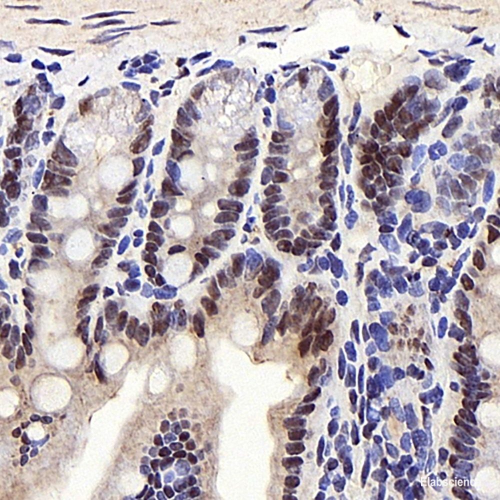 Immunohistochemistry analysis of paraffin-embedded human kidney using DICER1 Polyclonal Antibody at dilution of 1:400.