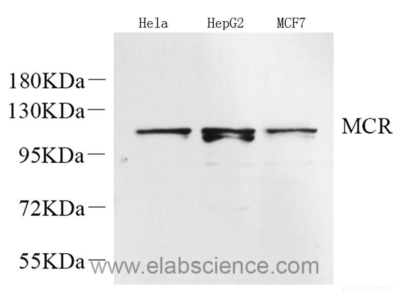 Immunohistochemistry analysis of paraffin-embedded human appendix using FAS Polyclonal Antibody at dilution of 1:500.