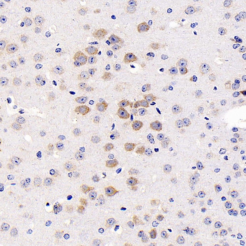 Immunohistochemistry analysis of paraffin-embedded human lymphoma using S100A4 Monoclonal Antibody at dilution of 1:300.
