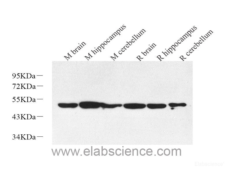 Immunofluorescence analysis of U-251 MG cells using Tau Polyclonal Antibody at dilution of 1:100 (40x lens). Blue: DAPI for nuclear staining.