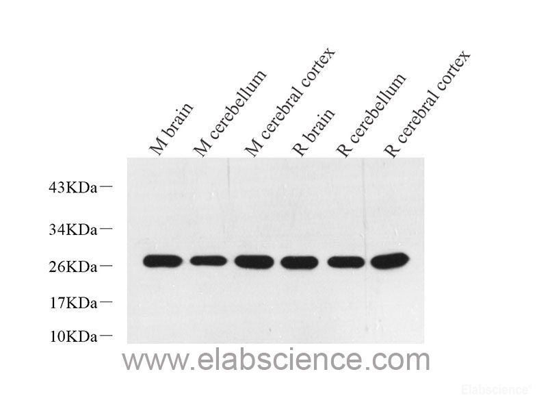 Immunofluorescence analysis of Y79 cells using Rb Polyclonal Antibody at dilution of 1:100 (40x lens). Blue: DAPI for nuclear staining.