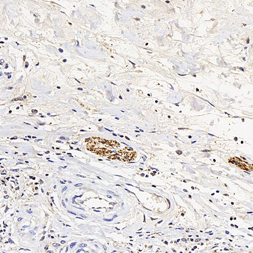 Immunofluorescence analysis of RAW264.7 cells using TLR4 Polyclonal Antibody at dilution of 1:100 (40x lens). Blue: DAPI for nuclear staining.