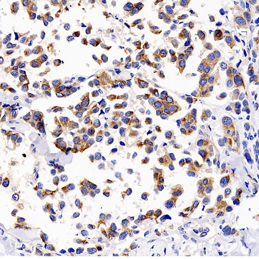 Immunohistochemistry of paraffin-embedded Rat brain using STAT1 Polyclonal Antibody at dilution of 1:100 (40x lens).