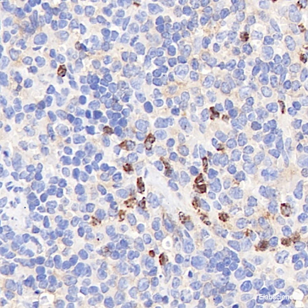 Immunohistochemistry of paraffin-embedded Rat brain using TH Polyclonal Antibody at dilution of 1:100 (40x lens).