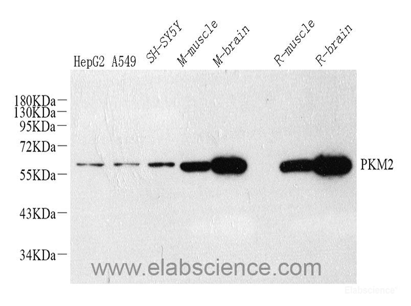 Immunofluorescence analysis of HeLa cells using TNFRSF1A Polyclonal Antibody