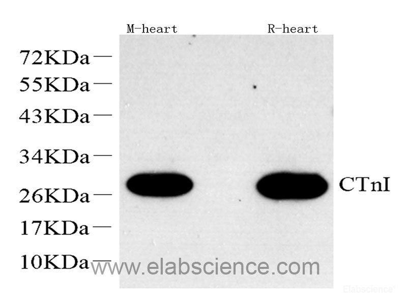Immunohistochemistry of paraffin-embedded Rat brain using PI3 Kinase p85 alpha Polyclonal Antibody at dilution of 1:100 (40x lens).