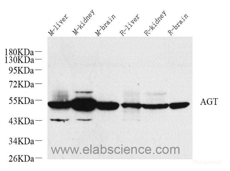 Western blot analysis of extracts of various cell lines using Perforin Polyclonal Antibody at dilution of 1:1000.