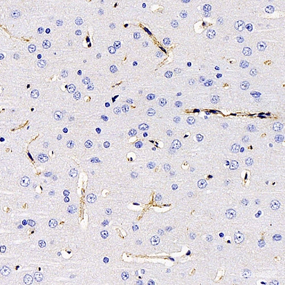 Immunohistochemistry of paraffin-embedded Rat heart using CAST Polyclonal Antibody at dilution of 1:100 (40x lens).