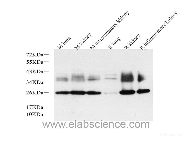Immunohistochemistry of paraffin-embedded Rat brain using FoxO3a Polyclonal Antibody at dilution of 1:100 (40x lens).
