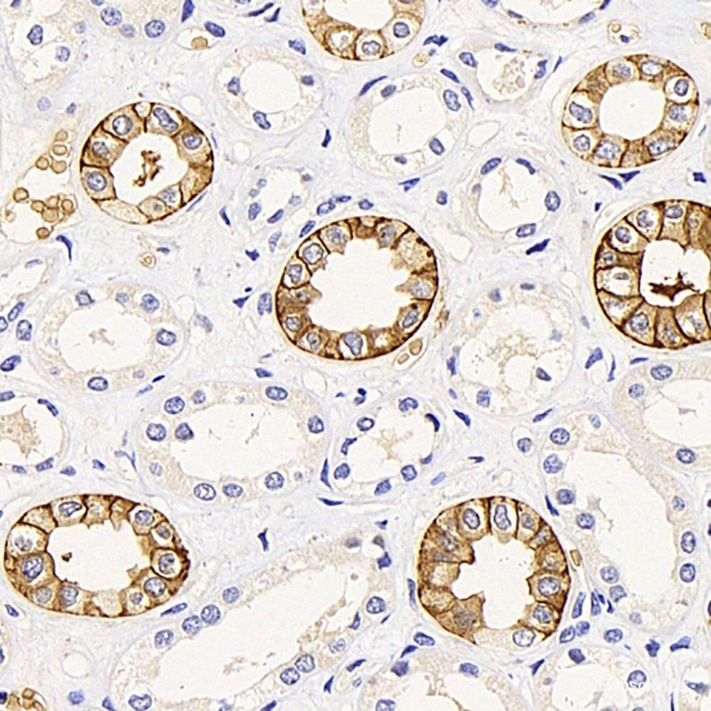 Immunofluorescence analysis of Rat brain using GRIA2 Polyclonal Antibody at dilution of 1:50. Blue: DAPI for nuclear staining.